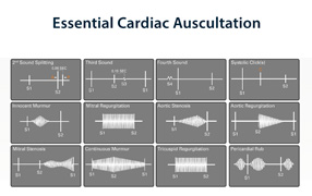 Essential Cardiac Auscultation PDF