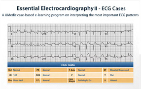 ECG Cases PDF