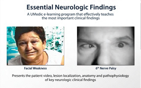 Neuro findings PDF