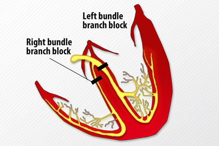 essential-ecg-2