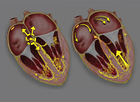 essential-ecg-3