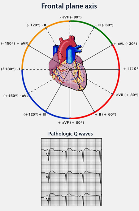 essential-ecg-4